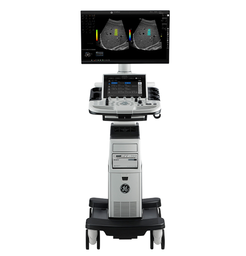 ultrasound image