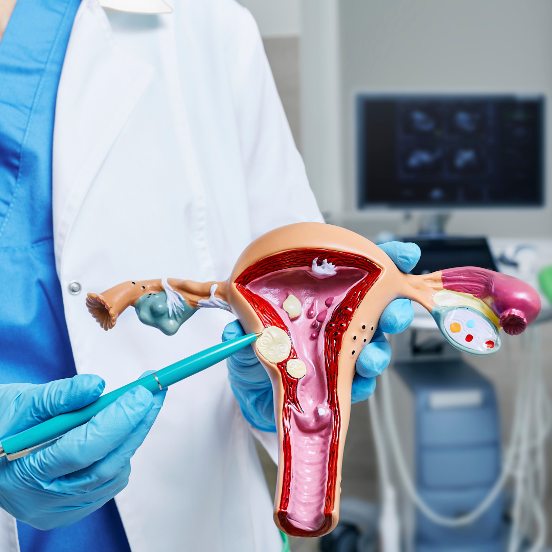 gynaecology-obstetrics image